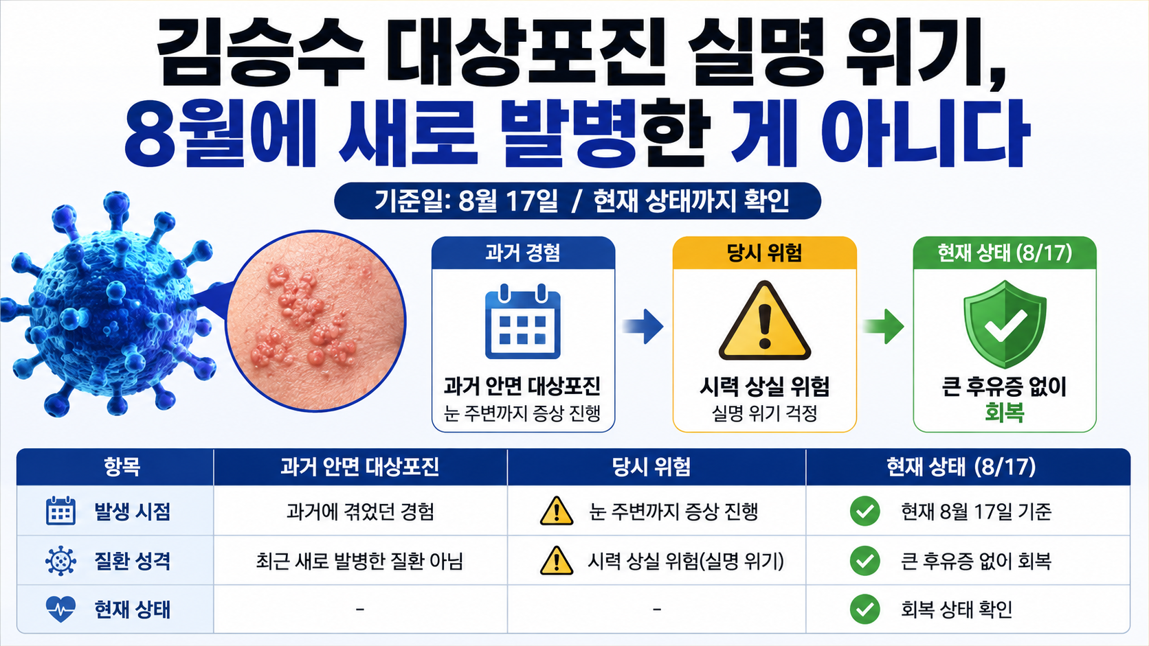 김승수의 과거 안면 대상포진 경험과 실명 위험 여부, 현재 회복 상태를 구분해 설명하는 정보 이미지
